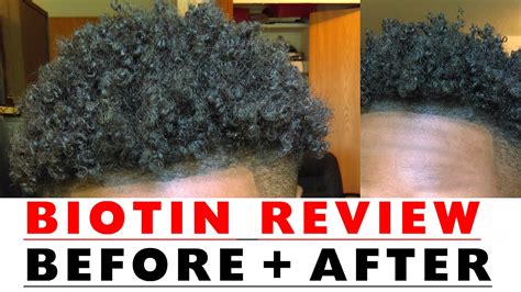 Biotin Hair Growth: Before and After Results (With Pictures).